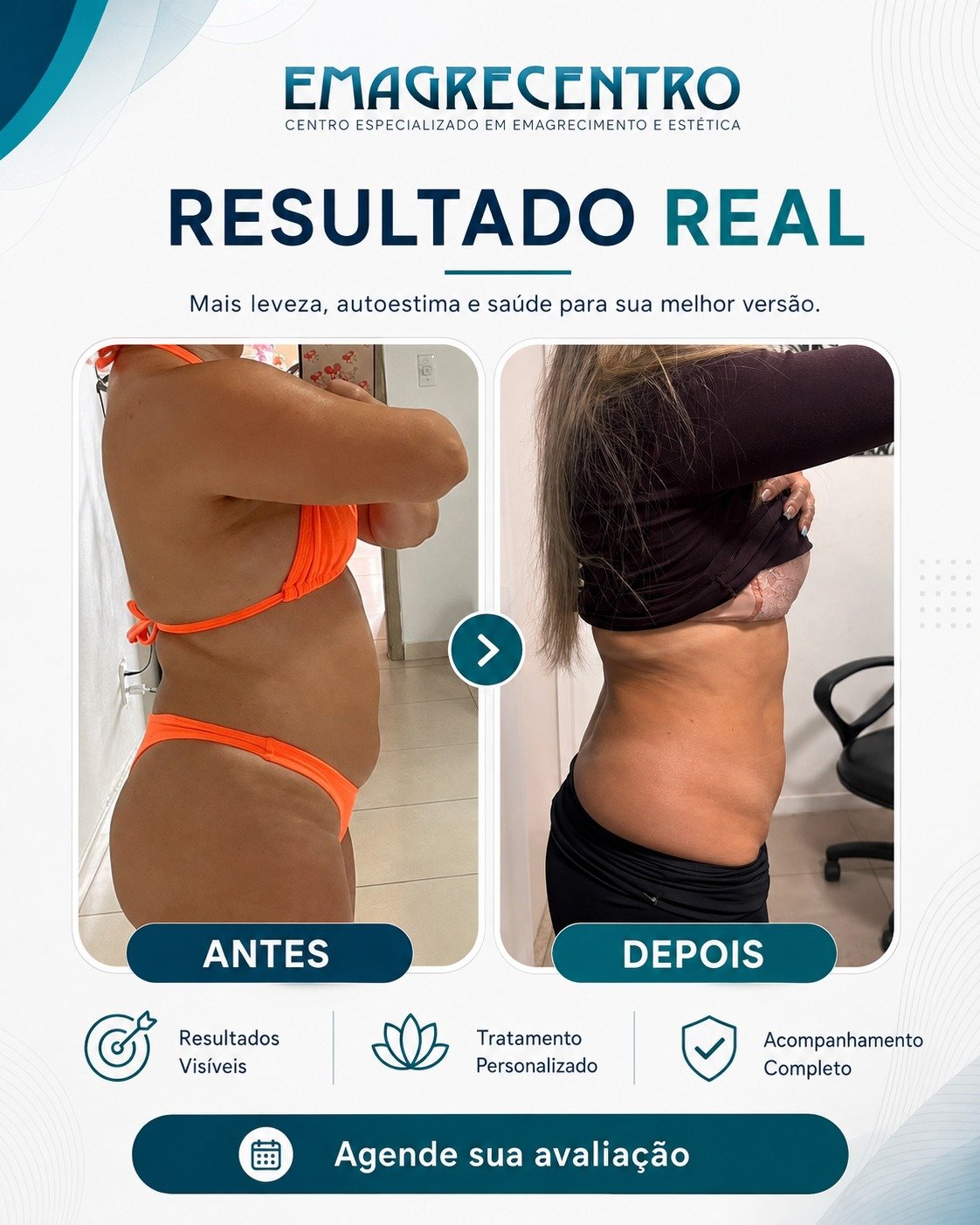 Resultado real Emagrecentro 4
